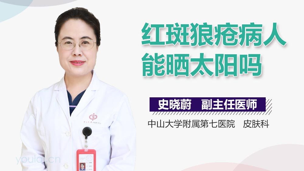 红斑狼疮病人能晒太阳吗