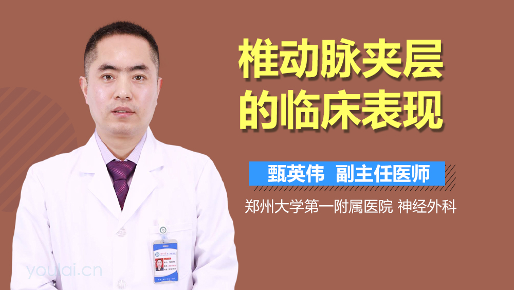 椎动脉夹层的临床表现