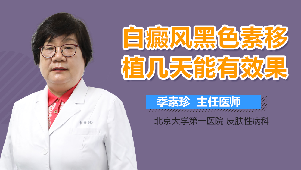 白癜风黑色素移植几天能有效果