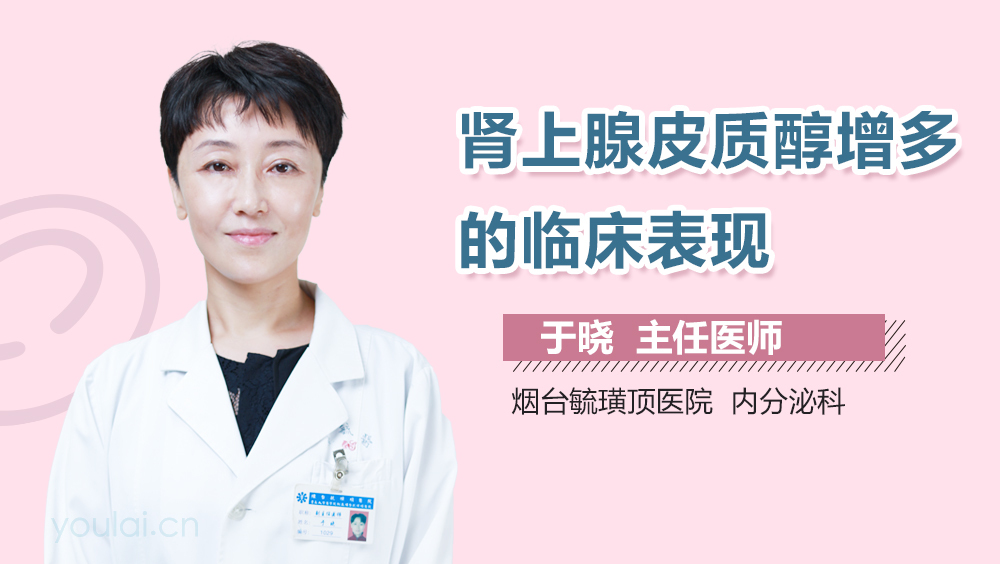 肾上腺皮质醇增多的临床表现