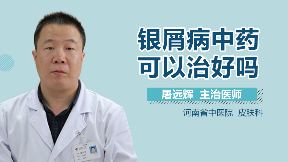 银屑病中药可以治好吗