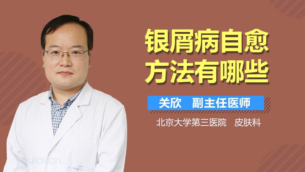 银屑病自愈方法有哪些