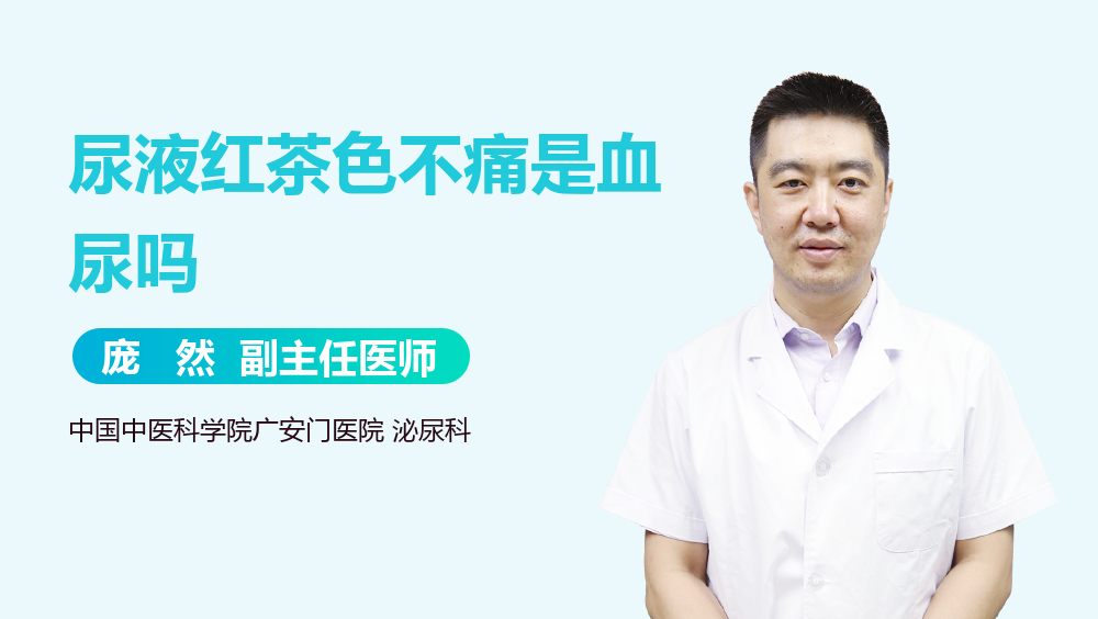 尿液红茶色不痛是血尿吗