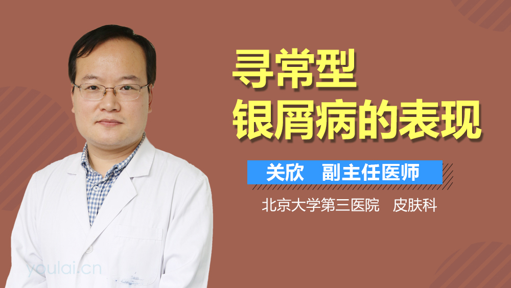 寻常型银屑病的表现