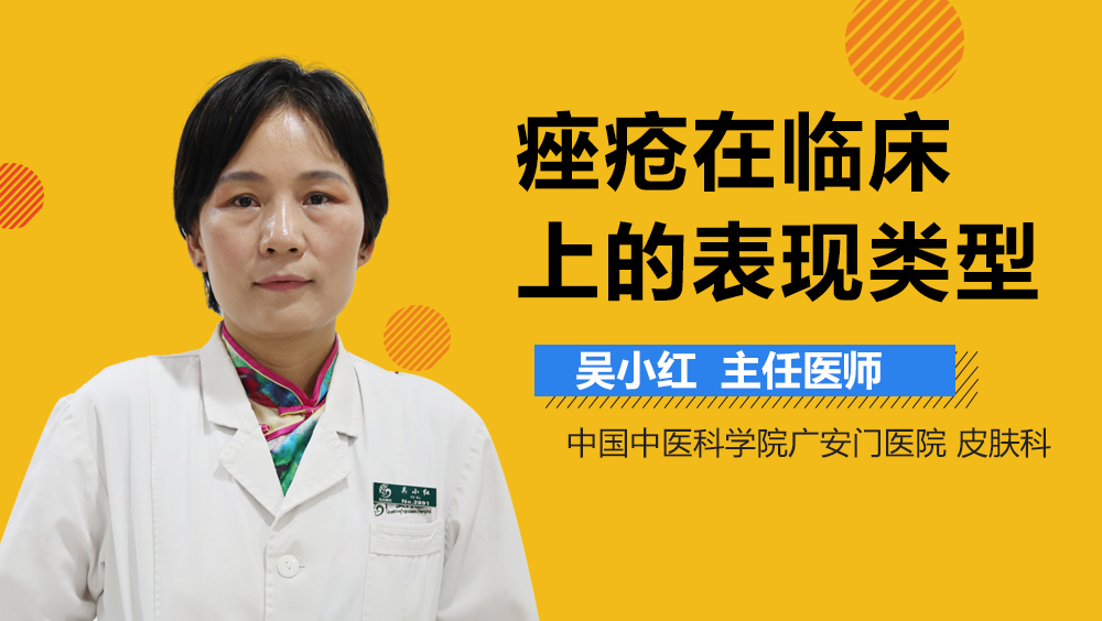 痤疮在临床上的表现类型