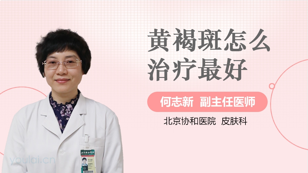 黄褐斑怎么治疗最好