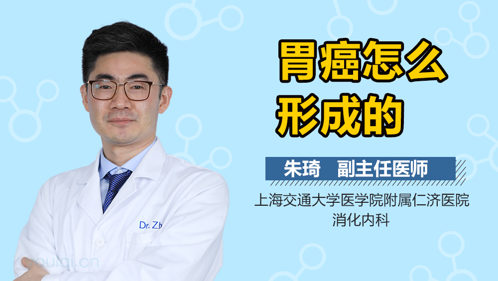 胃癌怎么形成的