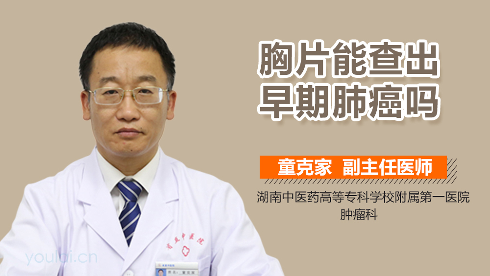 胸片能查出早期肺癌吗