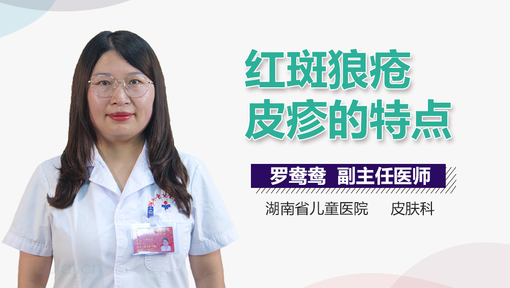 红斑狼疮皮疹的特点