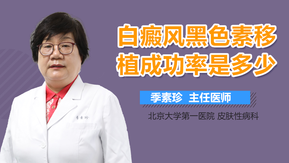 白癜风黑色素移植成功率是多少