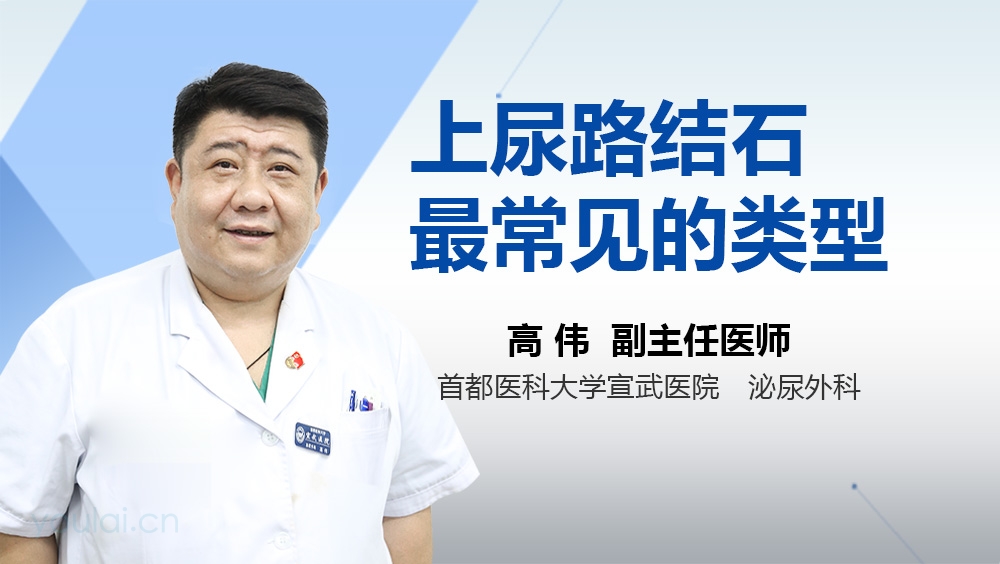 上尿路结石最常见的类型