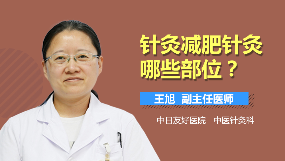 针灸减肥针灸哪些部位