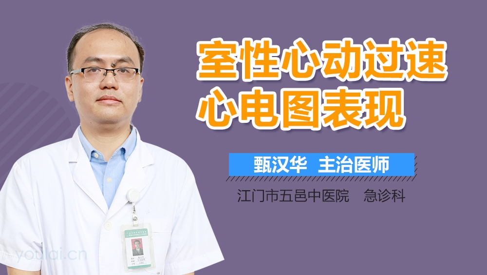 室性心动过速心电图表现