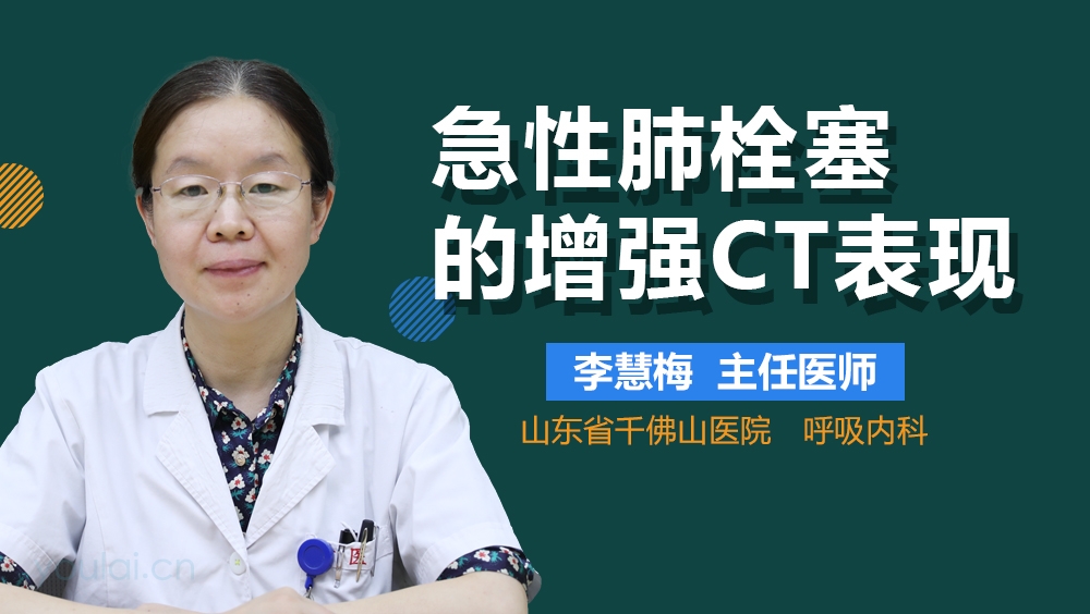 急性肺栓塞的增强CT表现