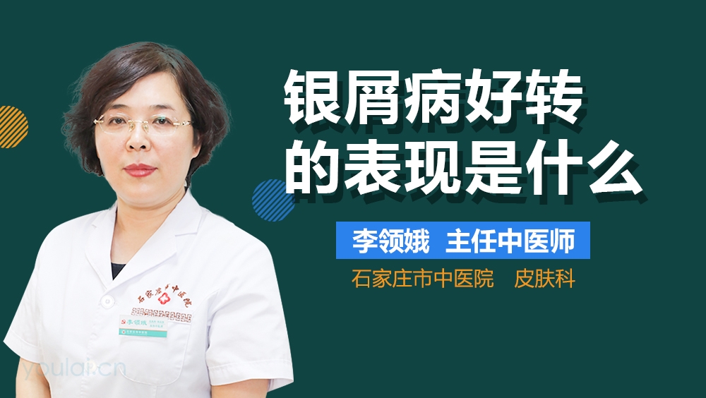 银屑病好转的表现是什么