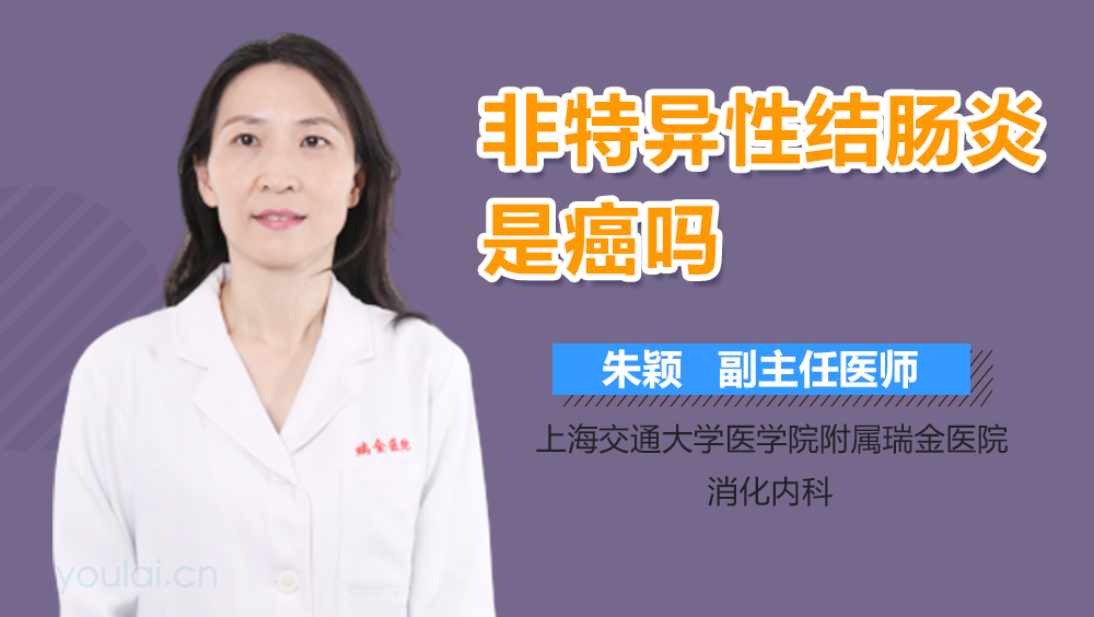 非特异性结肠炎是癌吗