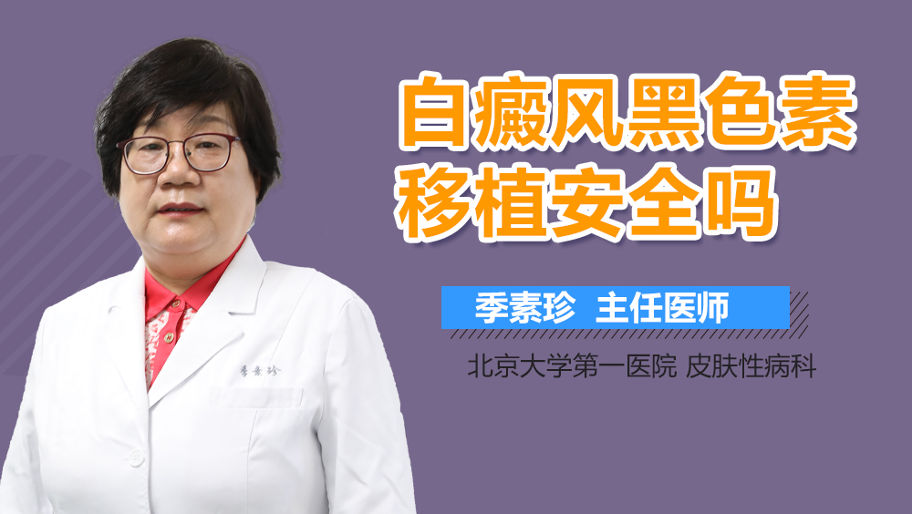 白癜风黑色素移植安全吗