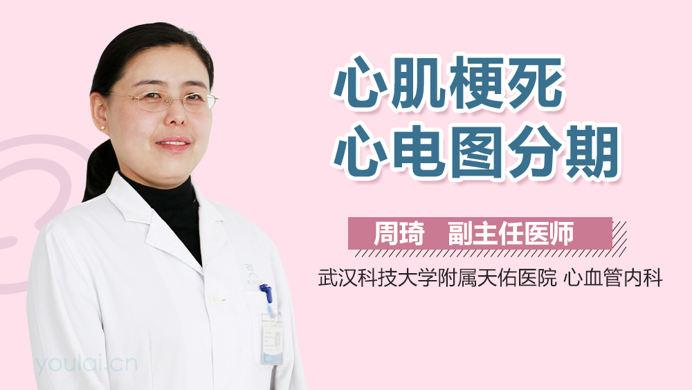 心肌梗死心电图分期