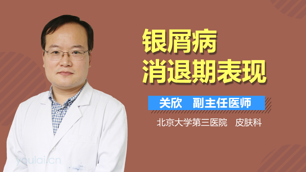 银屑病消退期表现