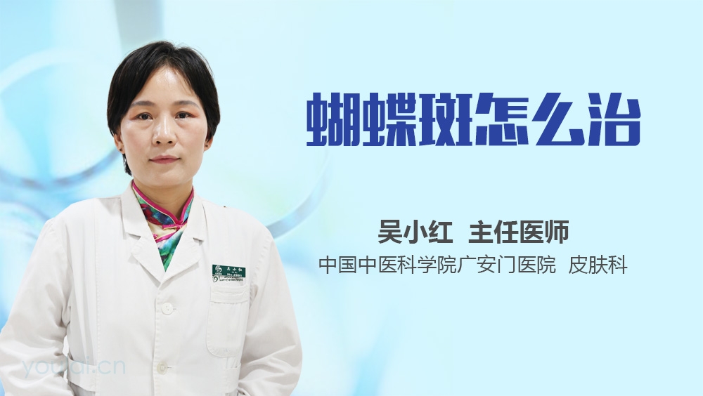 蝴蝶斑怎么治