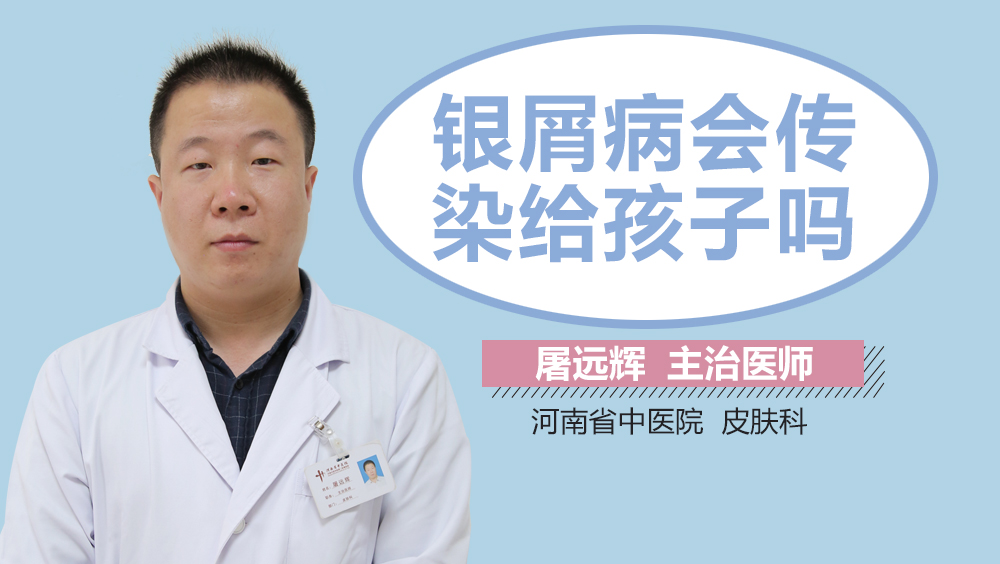 银屑病会传染给孩子吗