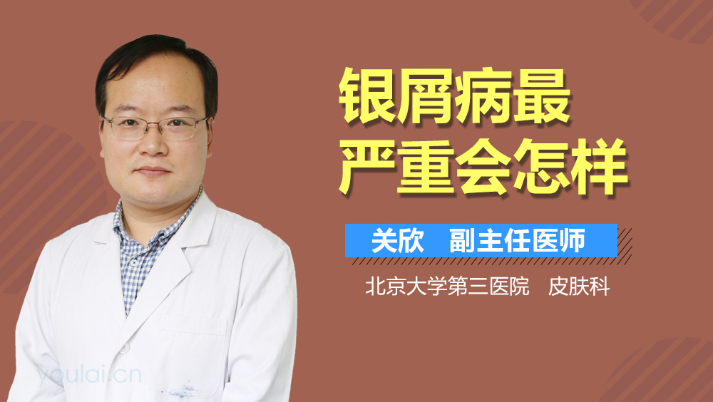银屑病最严重会怎样