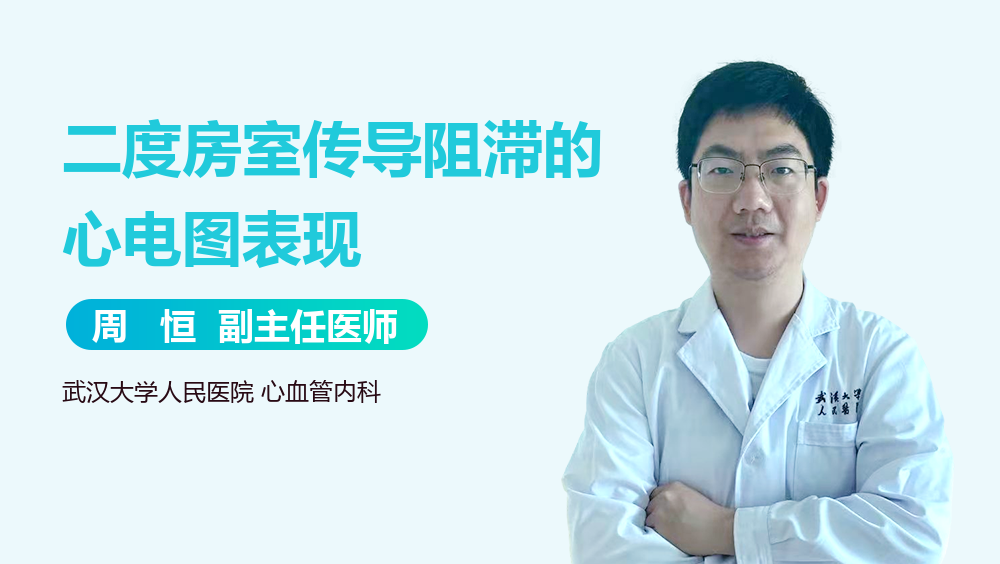 二度房室传导阻滞的心电图表现