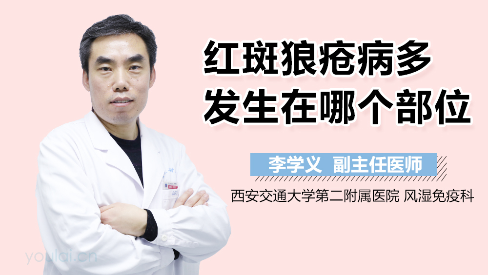 红斑狼疮病多发生在哪个部位
