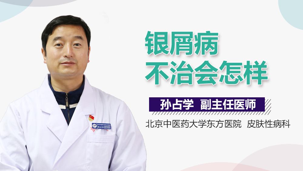 银屑病不治会怎样
