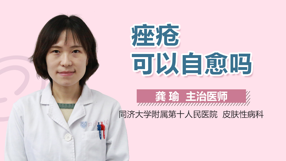 痤疮可以自愈吗
