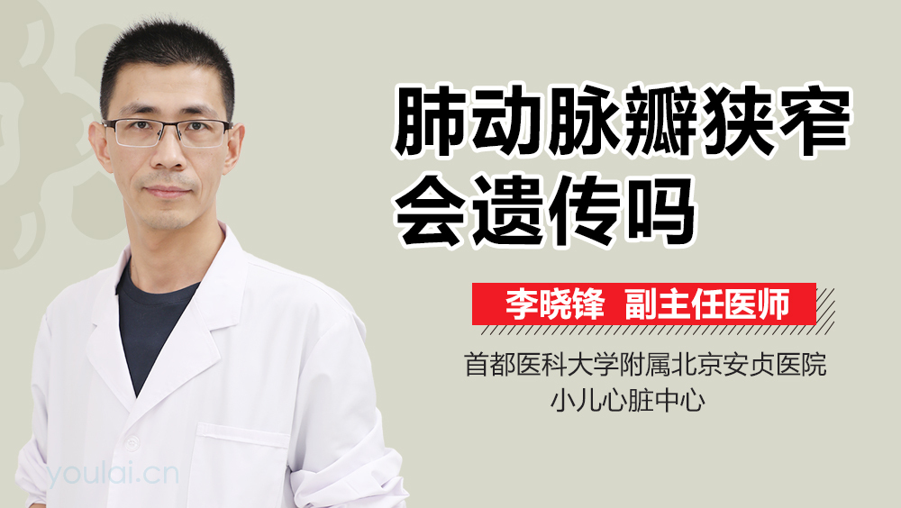 肺动脉瓣狭窄会遗传吗