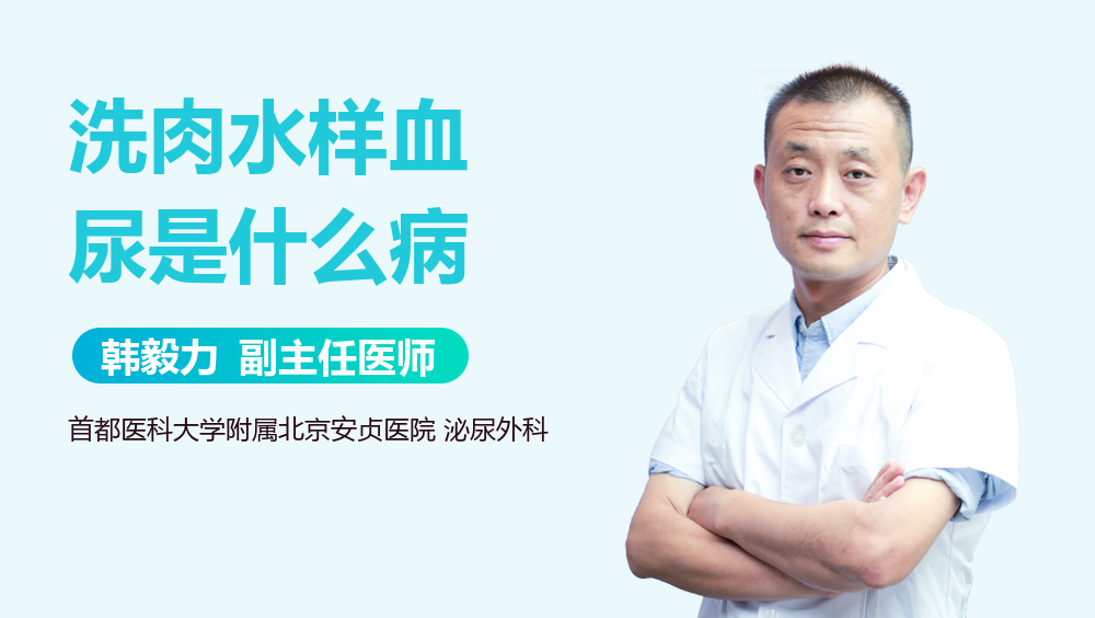 洗肉水样血尿是什么病