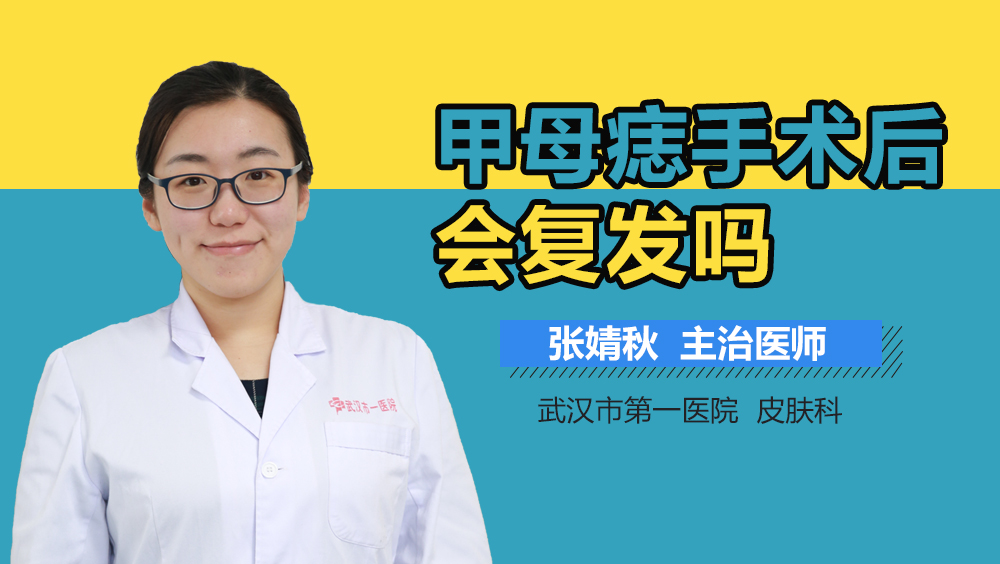 甲母痣手术后会复发吗