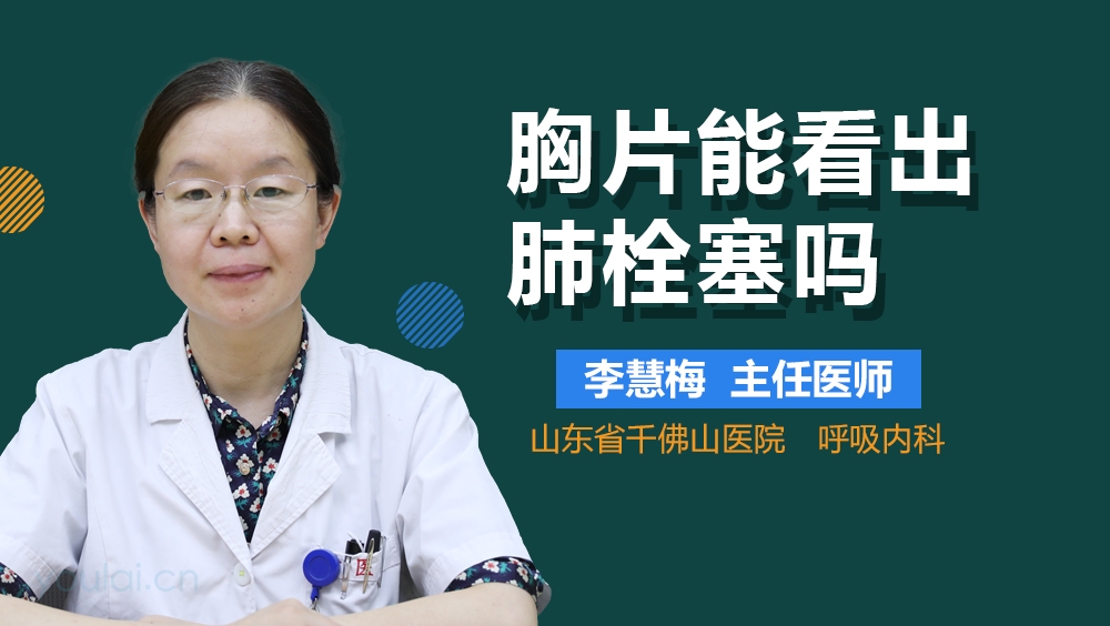 胸片能看出肺栓塞吗