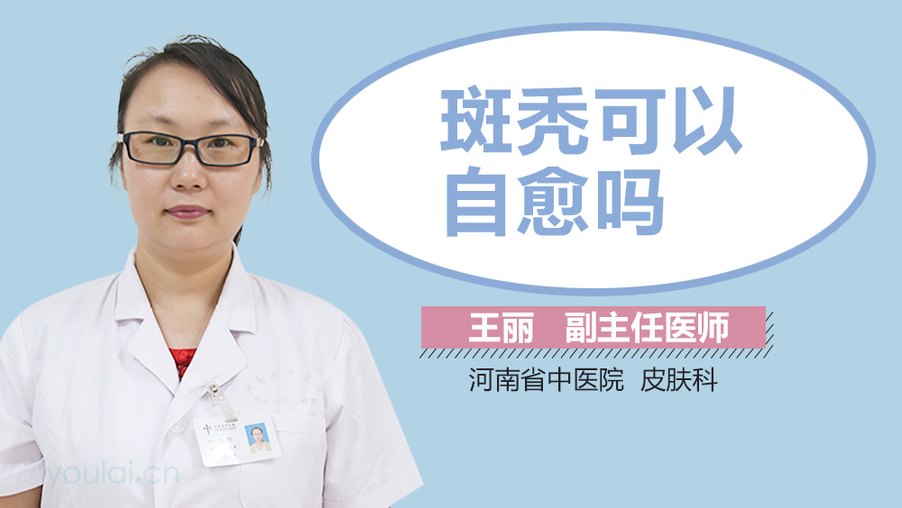 斑秃可以自愈吗
