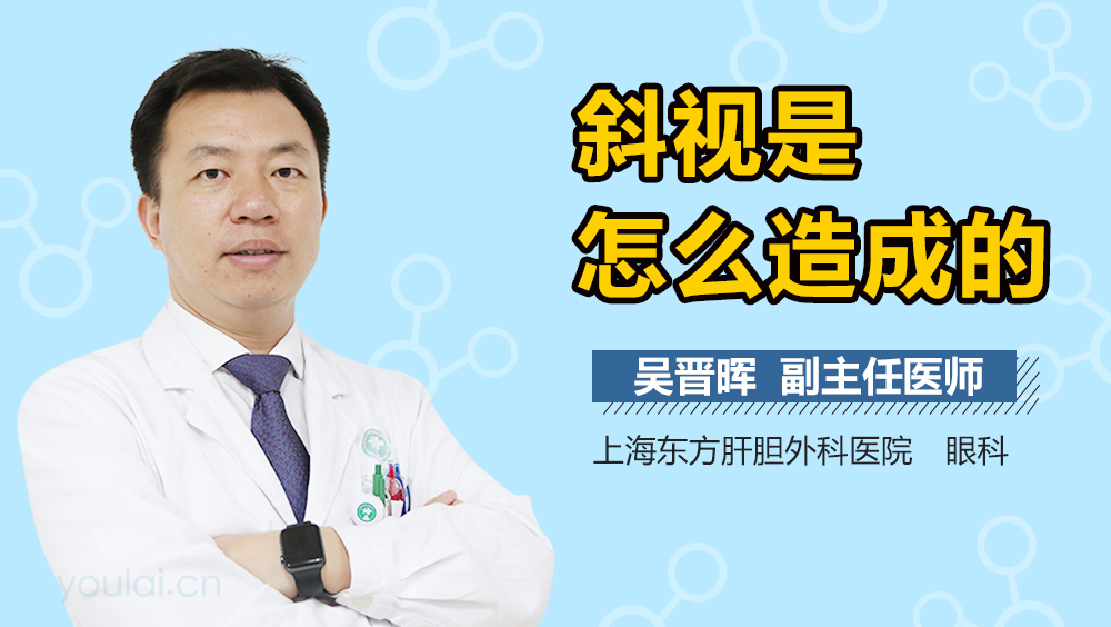 斜视是怎么造成的