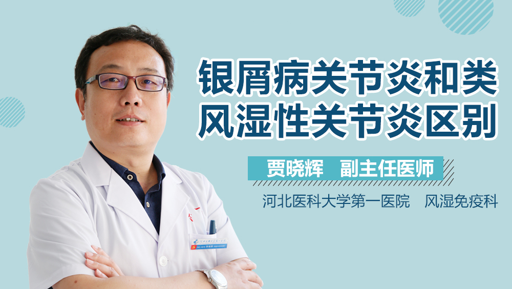 银屑病关节炎和类风湿性关节炎区别