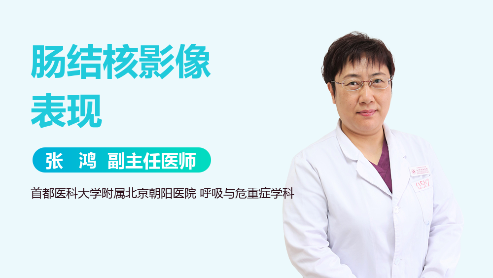 肠结核影像表现