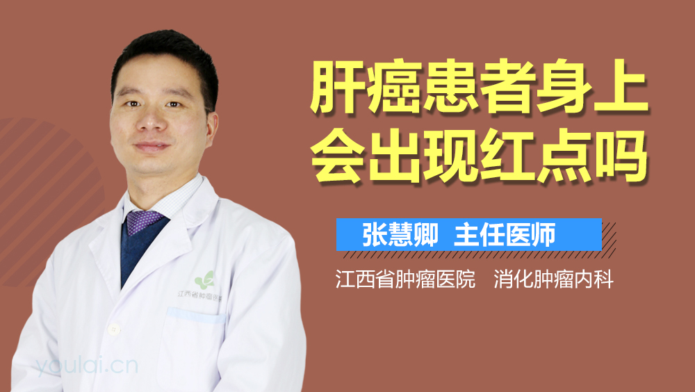 肝癌患者身上会出现红点吗