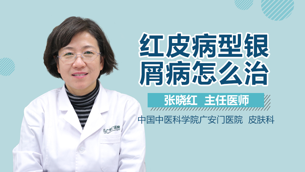 红皮病型银屑病怎么治