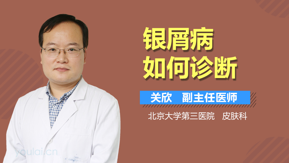 银屑病如何诊断