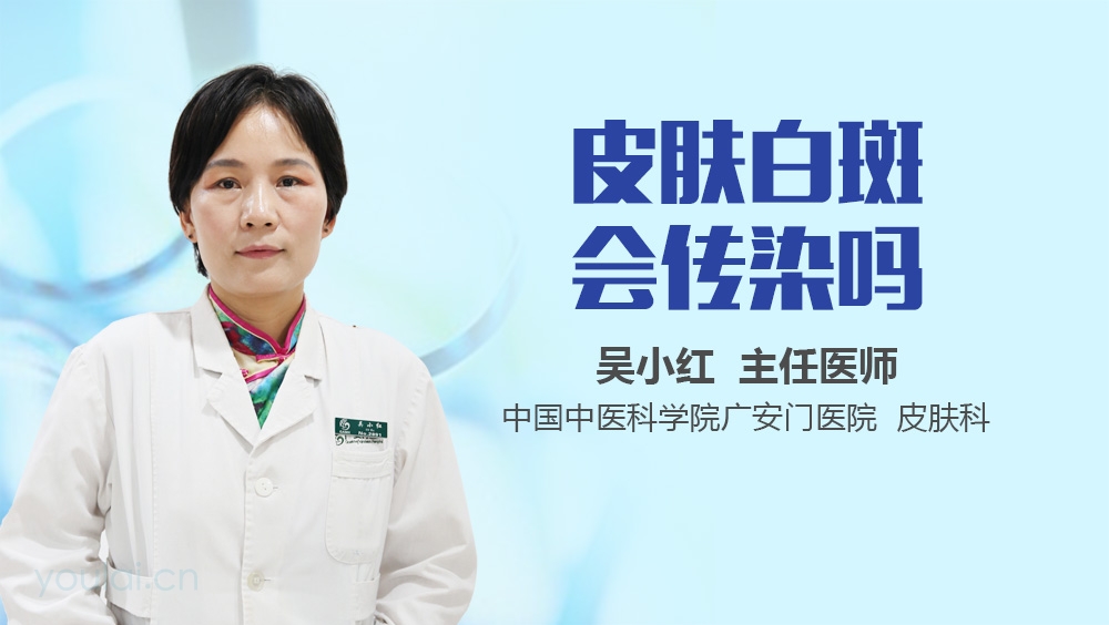 皮肤白斑会传染吗