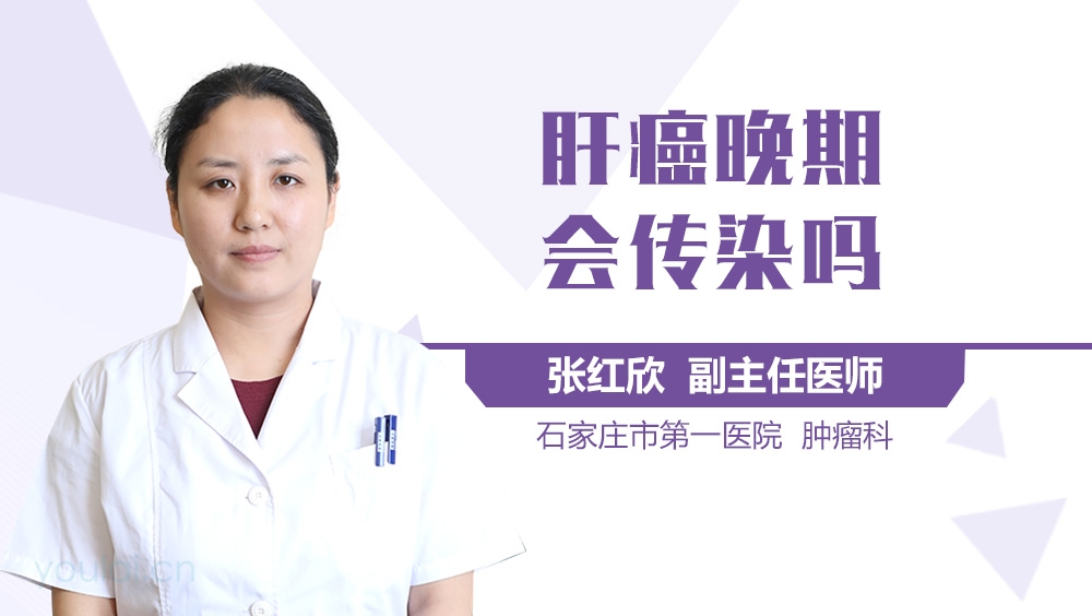 肝癌晚期会传染吗