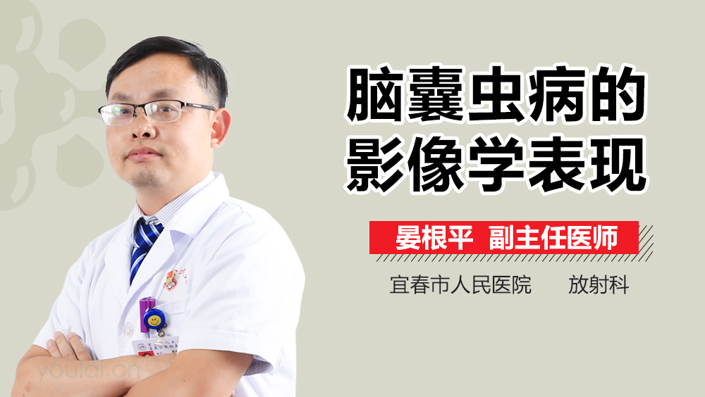 脑囊虫病的影像学表现