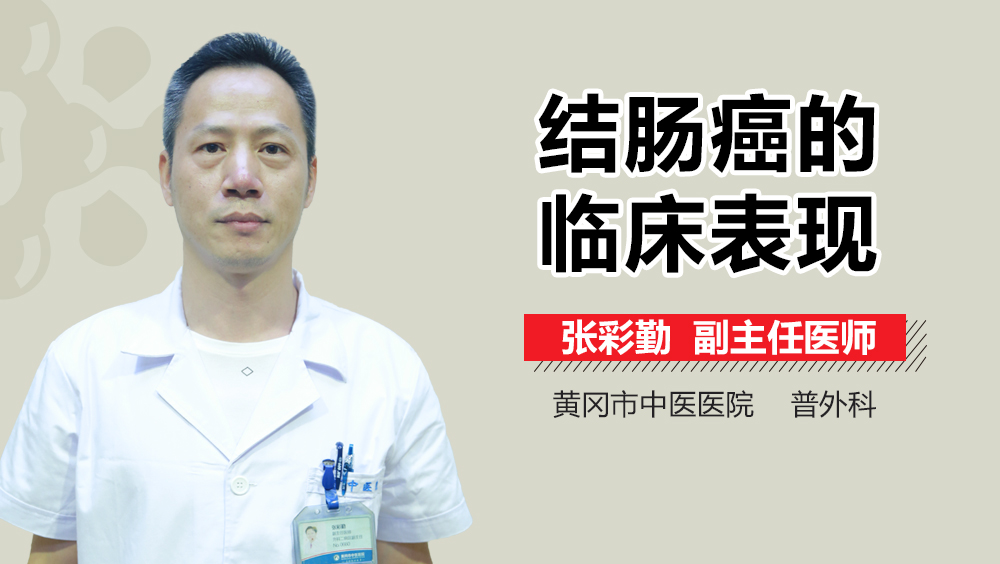 结肠癌的临床表现