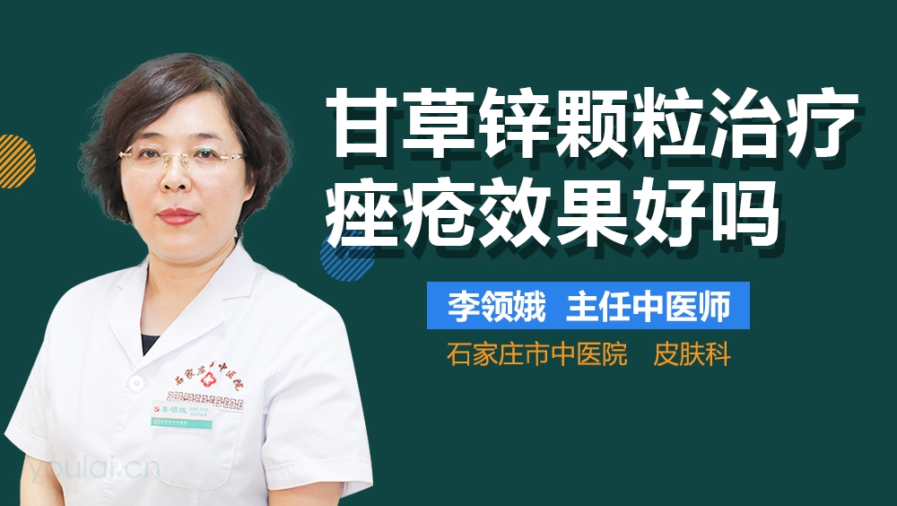 甘草锌颗粒治疗痤疮效果好吗