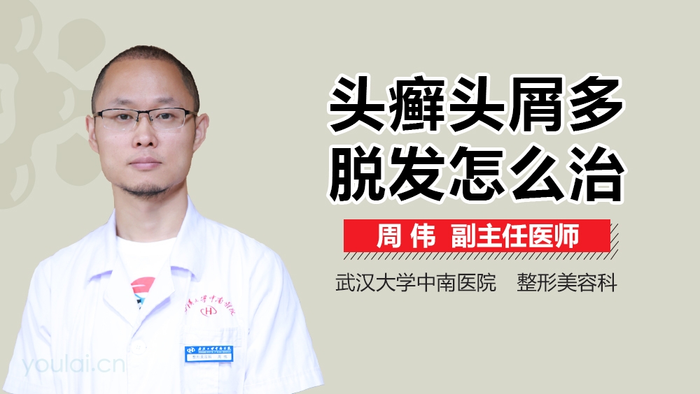 头癣头屑多脱发怎么治