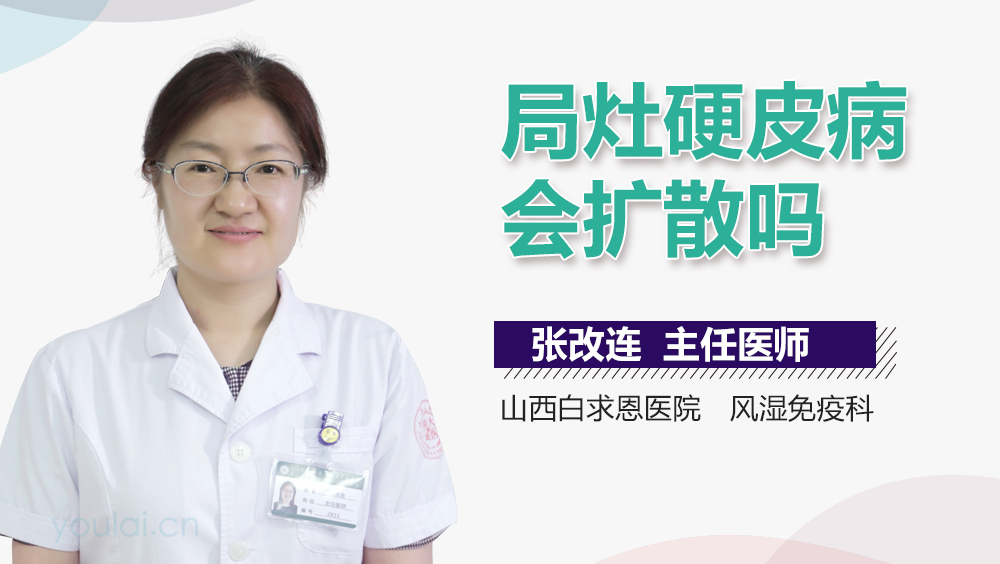 局灶硬皮病会扩散吗