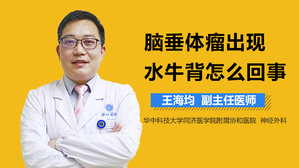 脑垂体瘤出现水牛背怎么回事