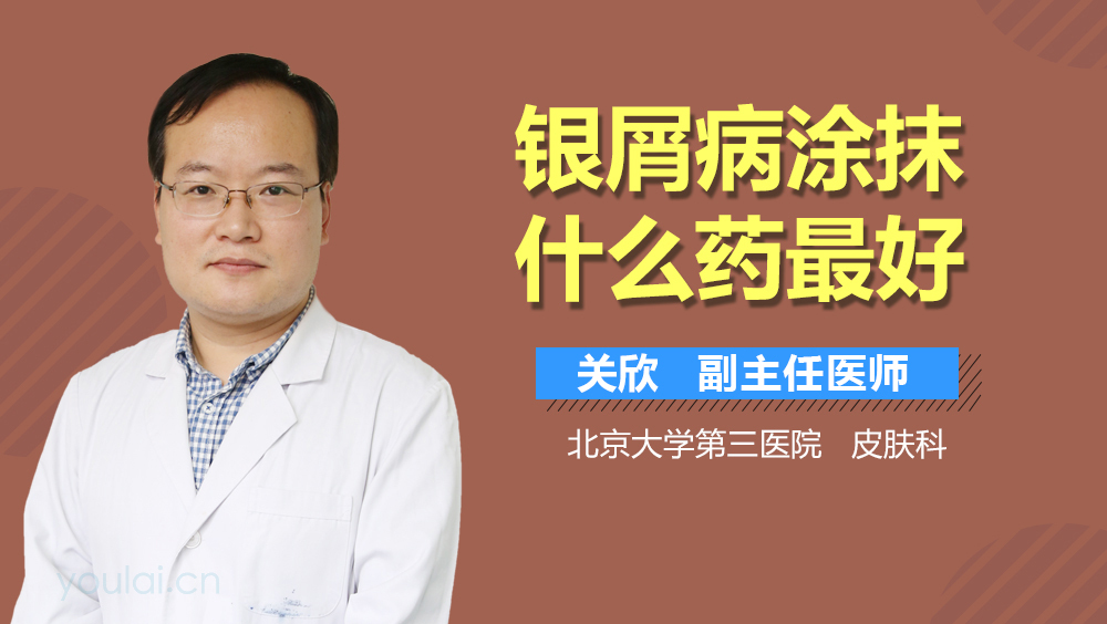 银屑病涂抹什么药最好